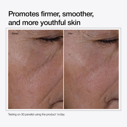 Multi-Peptide + HA Serum